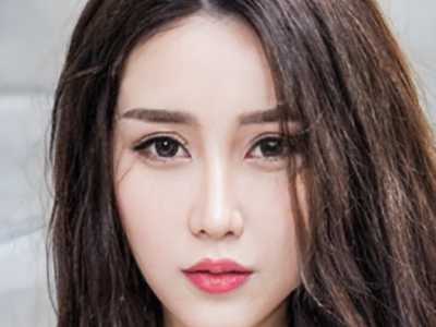 石家庄无痕专业双眼皮后怎么护理不会发炎